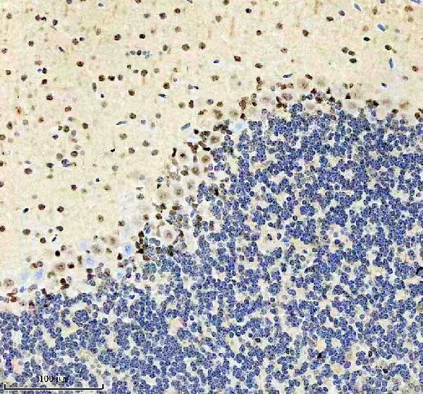 IHC analysis of SMAD2 using anti-SMAD2 antibody (P00090-3)