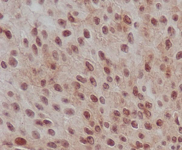 p00090 ihc