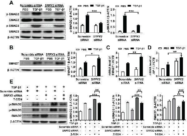 SRPX2 regulated TGF-β/SMADs signaling pathways by AP1 and SMAD7