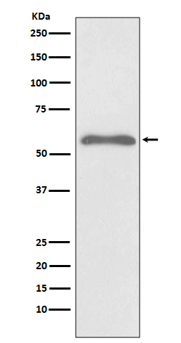 Western blot analysis of Phospho-Smad2 (S255) expression in Hela cell treated with Okadaic acid and Calyculin A lysate