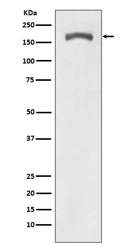 p00096 wb