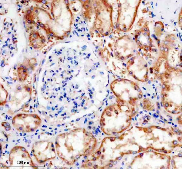 p00097 3 mapt primary antibodies ihc testing 1