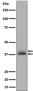 Western blot analysis of Phospho- Erk1 (T202/Y204) + Erk2 (T185/Y187) expression in A431 cell lysate treated with EGF