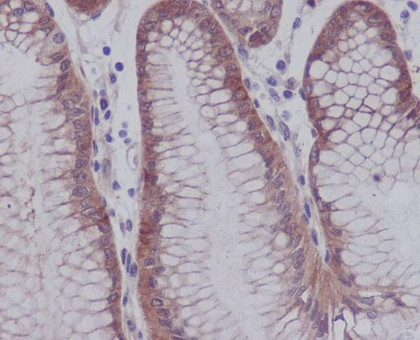 	Immunohistochemical analysis of paraffin-embedded human stomach, using Phospho-YAP1 (S127) Antibody