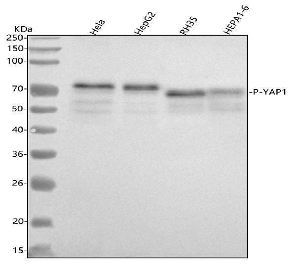  Western blot analysis of YAP1 using anti-YAP1 antibody (P00116)