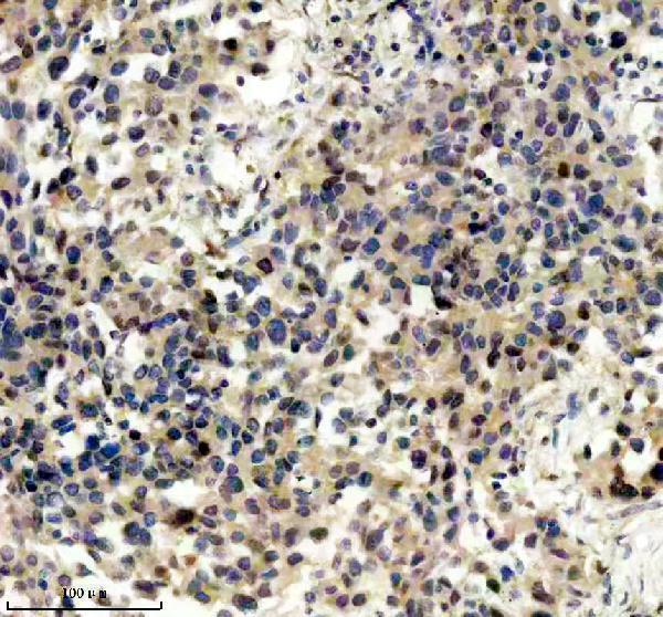 IHC analysis of P-EIF4E using anti-P-EIF4E antibody (P00135)