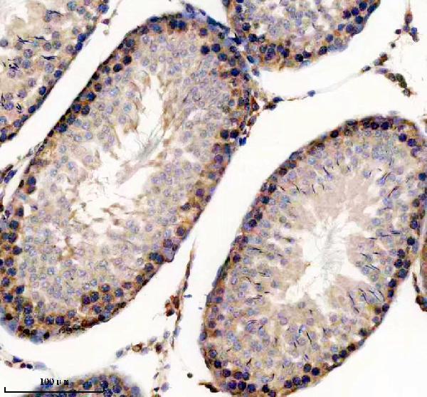 IHC analysis of P-EIF4E using anti-P-EIF4E antibody (P00135)