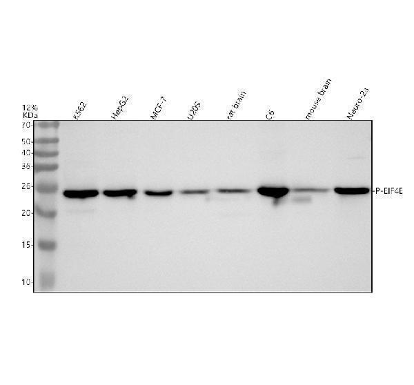 Western blot analysis of P-EIF4E using anti-P-EIF4E antibody (P00135)