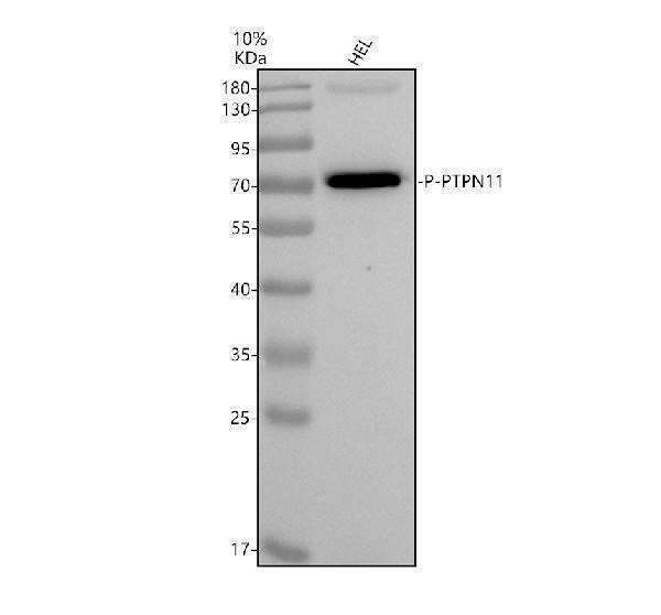 Western blot analysis of SHP2/PTPN11 using anti-SHP2/PTPN11 antibody (P00150)