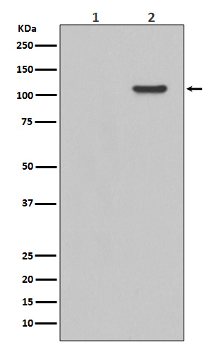 p00151 wb