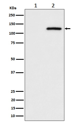 Western blot analysis of Phospho-CBL (S669) expression in (1) HeLa cell lysate; (2) HeLa cell treated with pervanadate lysate