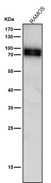 All lanes use the Antibody at 1:2K dilution for 1 hour at room temperature