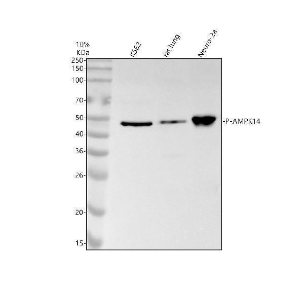 Western blot analysis of P-AMPK14(T178,T182) using anti-P-AMPK14(T178,T182) antibody (P00176-2)