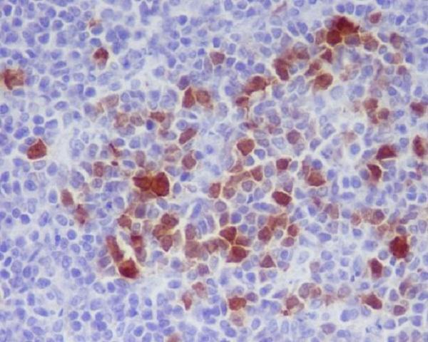 Immunohistochemical analysis of paraffin-embedded rat spleen, using Phospho-Cdk1/2 (T14) Antibody