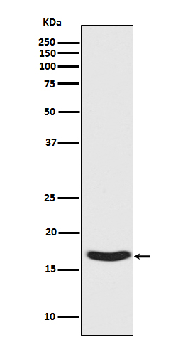 Western blot analysis of Synuclein phosphorylation expression in Human fetal brain lysate