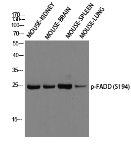 Western blot analysis of MOUSE-KIDNEY MOUSE-BRAIN MOUSE-SPLEEN MOUSE-LUNG using p-FADD (S194) antibody