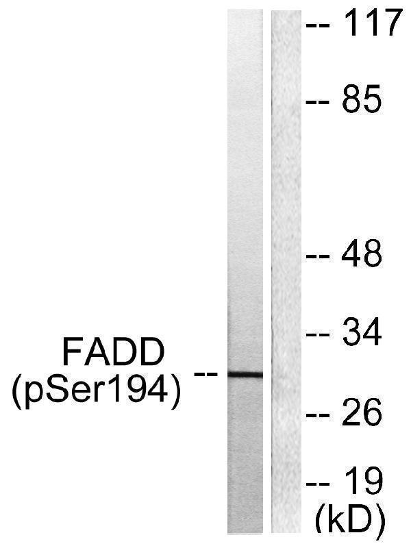 Western blot analysis of lysates from HeLa cells treated with Paclitaxel 1uM 60