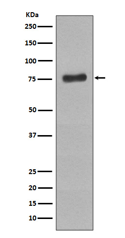 Western blot analysis of Phospho-BTK (Y223) expression in Raji cell lysate treated with pervanadate