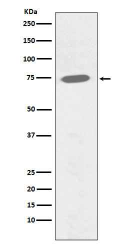 Western blot analysis of Phospho-BTK (Y551) expression in Ramos cell lysate treated with Pervanadate