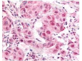 p00257 e2f1 primary antibodies ihc testing 1