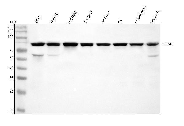  Western blot analysis of NAK/TBK1 using anti-NAK/TBK1 antibody (P00261)