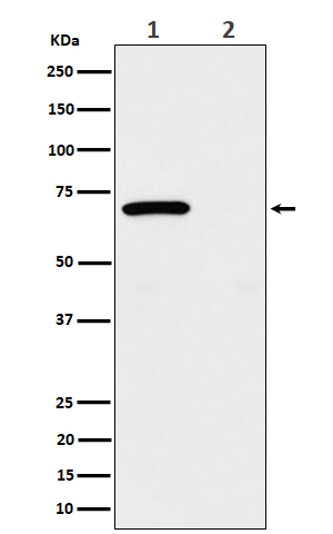 Western blot analysis of Phospho-Chk2 (T68) expression in (1) 293 treated with UV and Untreated cell lysate; (2) Untreated