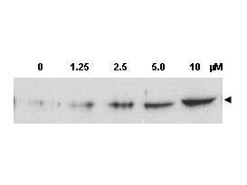 p00277 chek2 primary antibodies wb testing 1