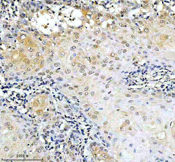 IHC analysis of NF-κB p65/RELA using anti-NF-κB p65/RELA antibody (P00284-2)