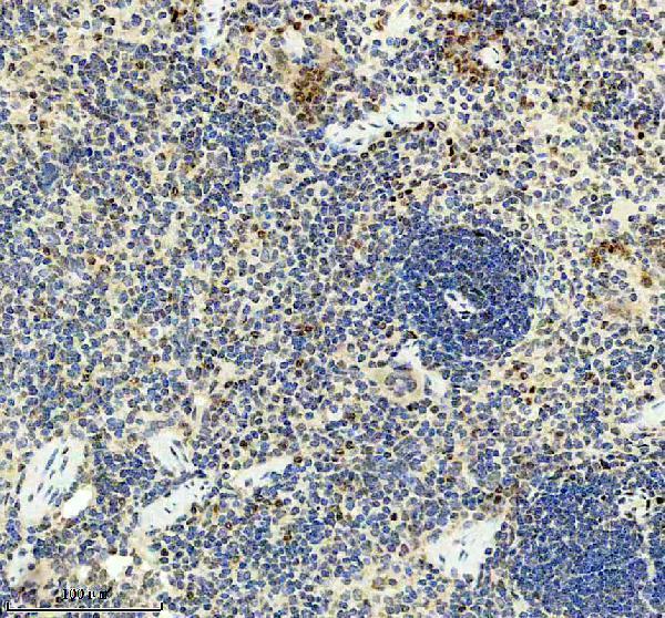 IHC analysis of NF-κB p65/RELA using anti-NF-κB p65/RELA antibody (P00284-2)