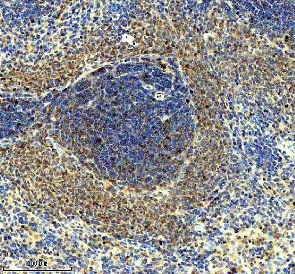 IHC analysis of NF-κB p65/RELA using anti-NF-κB p65/RELA antibody (P00284-2)