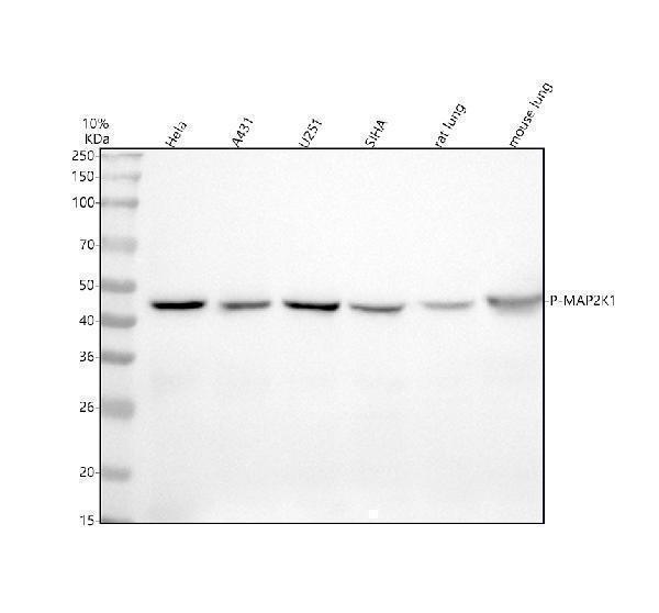  Western blot analysis of Phospho-MEK1 (S298) using anti-Phospho-MEK1 (S298) antibody (P00292-3)