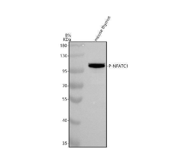Western blot analysis of NFATC1 using anti-NFATC1 antibody (P00340-1)