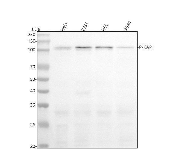  Western blot analysis of KAP1 using anti-KAP1 antibody (P00409)