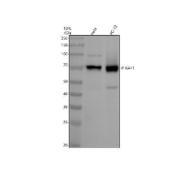 Western blot analysis of P-RAF1 using anti-P-RAF1 antibody (P00446-3)