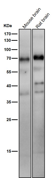 All lanes use the Antibody at 1:2K dilution for 1 hour at room temperature