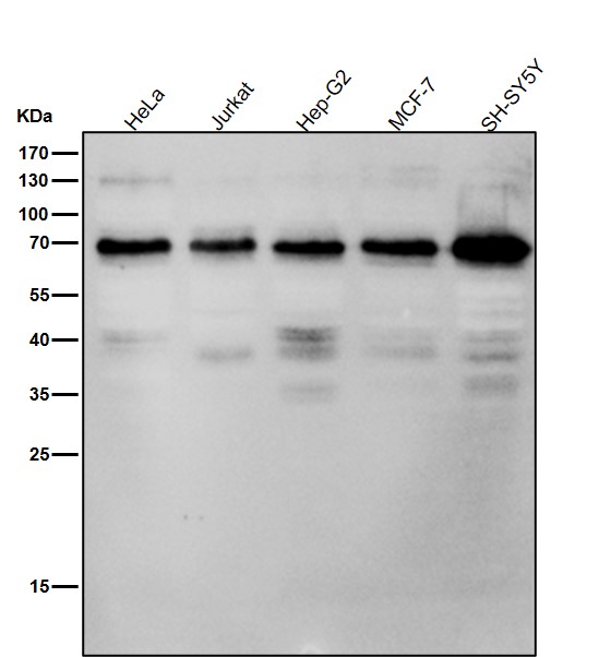 All lanes use the Antibody at 1:2K dilution for 1 hour at room temperature