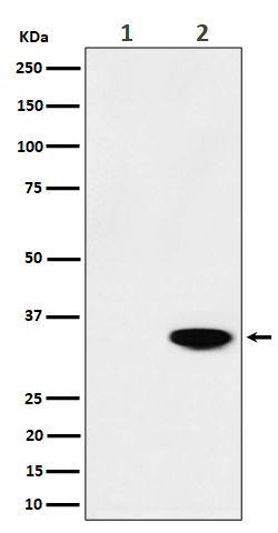 Western blot analysis of Phospho-Nucleophosmin (T199) expression in (1) HeLa cell lysate; (2) HeLa cell treated with CA lysate
