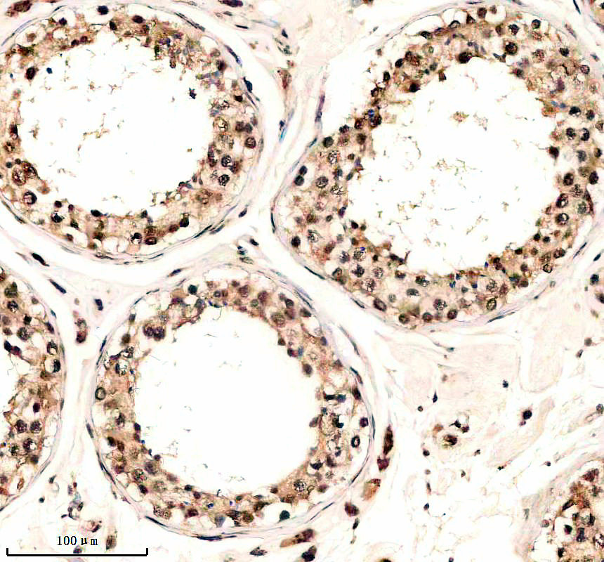 IHC analysis of P-CCNE1(T77) using anti-P-CCNE1(T77) antibody (P00543)