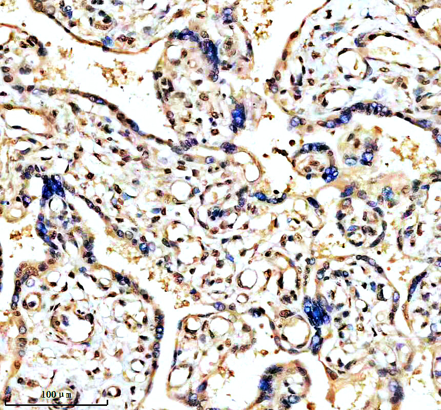 IHC analysis of P-CCNE1(T77) using anti-P-CCNE1(T77) antibody (P00543)