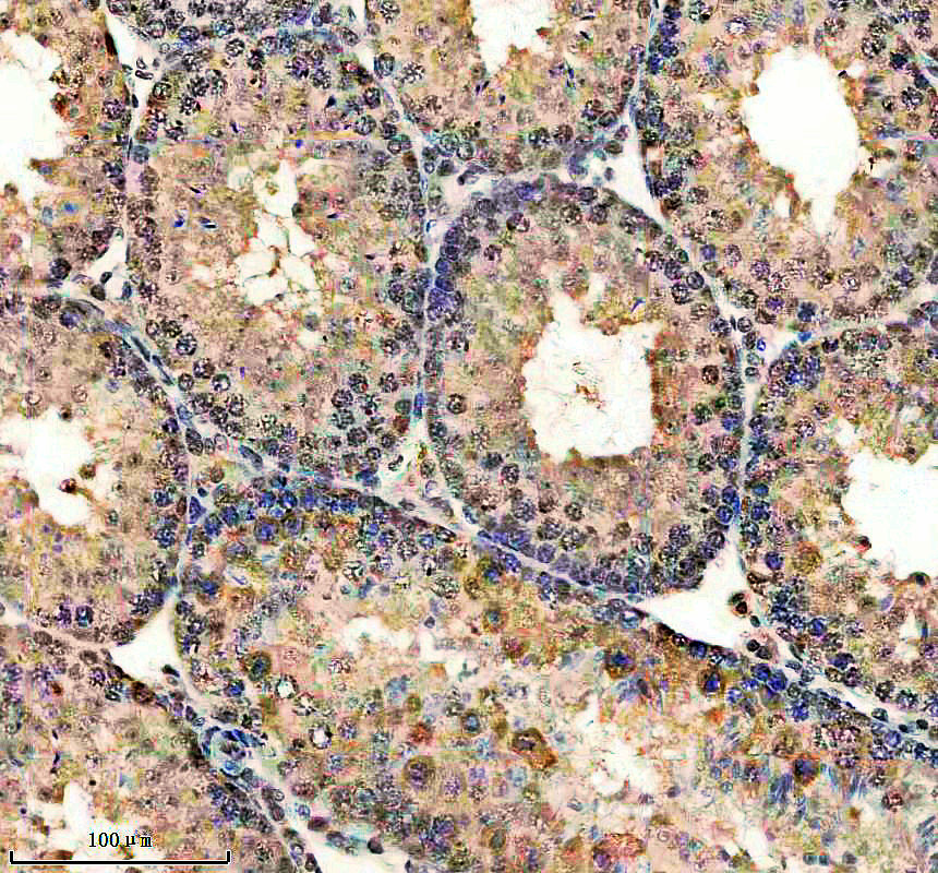 p00543 p ccne1 primary antibodies ihc testing 3