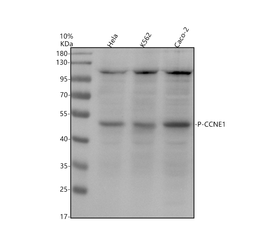 Western blot analysis of P-CCNE1(T77) using anti-P-CCNE1(T77) antibody (P00543)