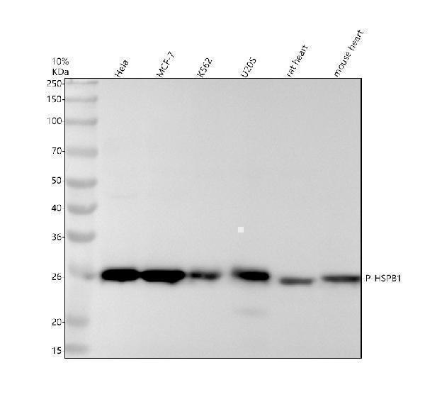 Western blot analysis of P-HSP27 using anti-P-HSP27 antibody (P00676-1)