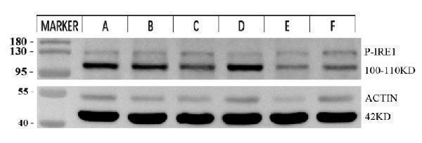 p00683 p ire1 primary antibodies wb testing 1