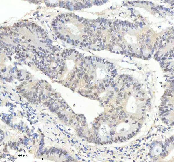IHC analysis of P-PRKCA using anti-P-PRKCA antibody (P00743)