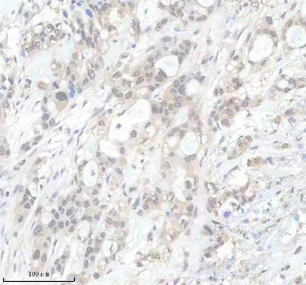 IHC analysis of P-PRKCA using anti-P-PRKCA antibody (P00743)