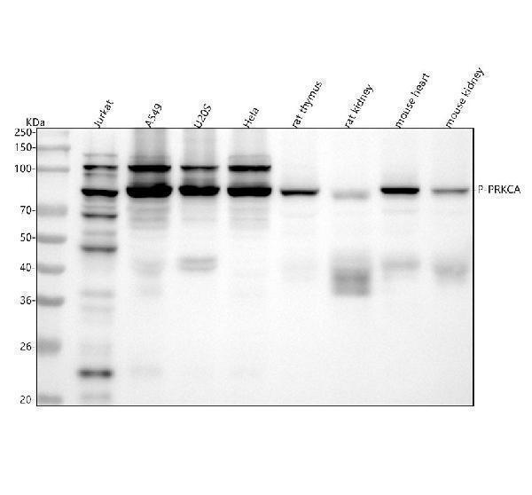  Western blot analysis of PRKCA using anti-PRKCA antibody (P00743)