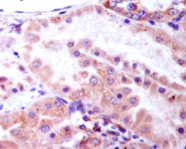 p00791 1 ihc