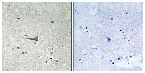 p00905 ddr1 primary antibodies ihc testing 4