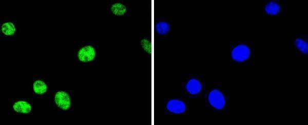 p00916 3 atf2 primary antibodies if testing 2