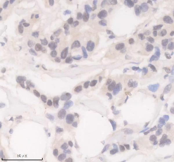 IHC analysis of P-POLR2A using anti-P-POLR2A antibody (P01029-1)